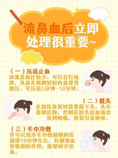儿童流鼻血最简单处理方法是什么?-第1张图片-中州医学会 儿童流鼻血最简单处理方法是什么?-第1张图片-中州医学会
