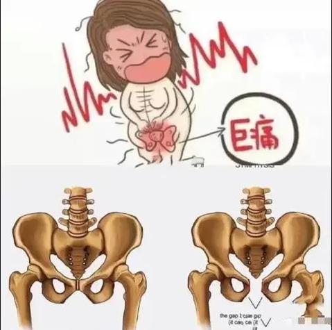 孕期大腿根部与胯连接处酸痛怎么办？-第2张图片-中州医学会