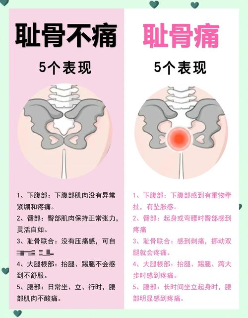 孕期大腿根部与胯连接处酸痛怎么办？-第3张图片-中州医学会