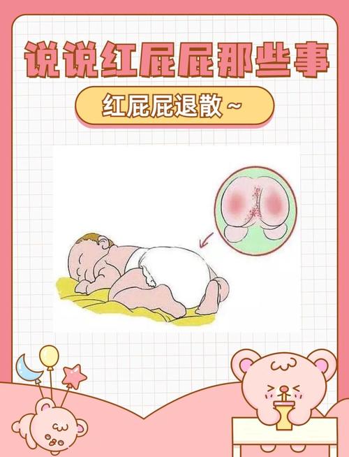 新生儿屁屁发红有红点咋办?-第2张图片-中州医学会 新生儿屁屁发红有红点咋办?-第2张图片-中州医学会