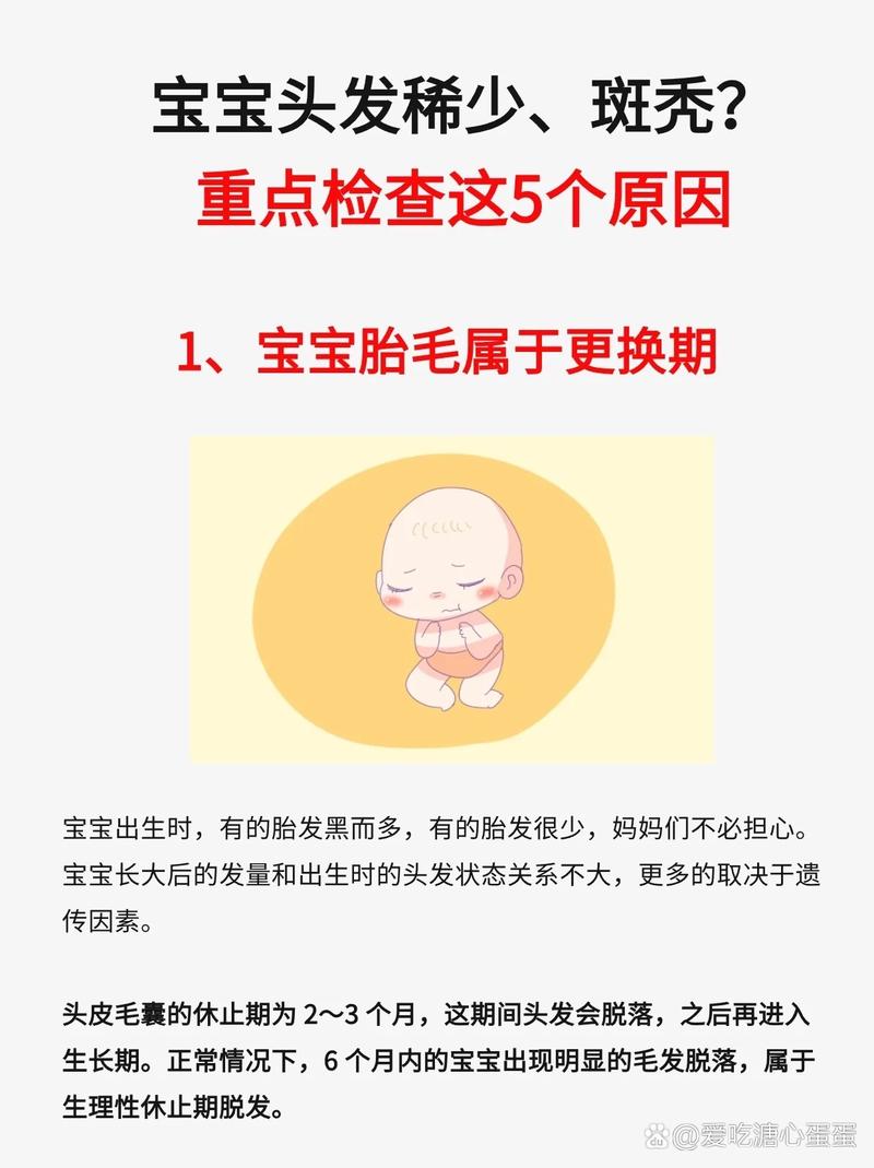 新生儿头顶头发稀少是何原因？-第2张图片-中州医学会