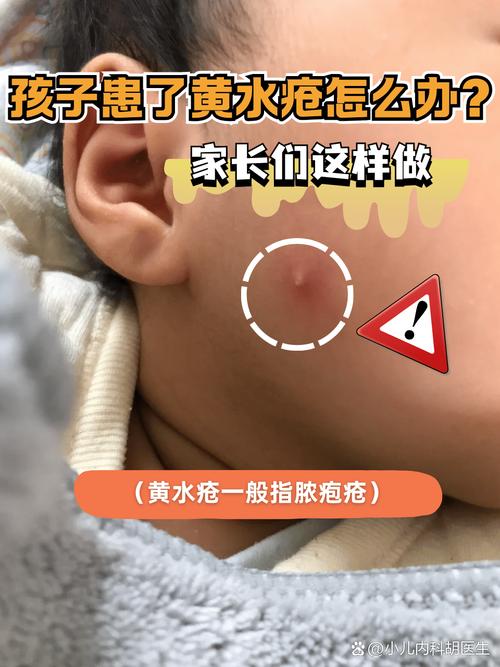 儿童脓毒血症能彻底根治吗?-第1张图片-中州医学会 儿童脓毒血症能彻底根治吗?-第1张图片-中州医学会