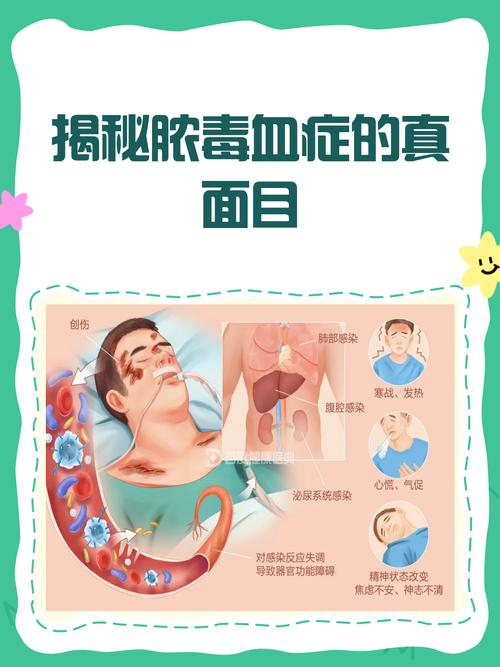 儿童脓毒血症能彻底根治吗?-第2张图片-中州医学会 儿童脓毒血症能彻底根治吗?-第2张图片-中州医学会