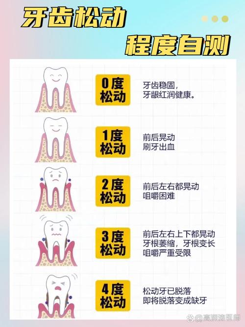 儿童门牙松动一直不掉怎么办？-第2张图片-中州医学会