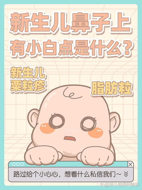 新生儿鼻头小白点是何原因？-第2张图片-中州医学会