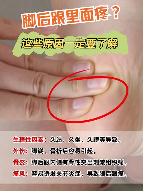 儿童脚后跟疼是什么原因有三-第2张图片-中州医学会