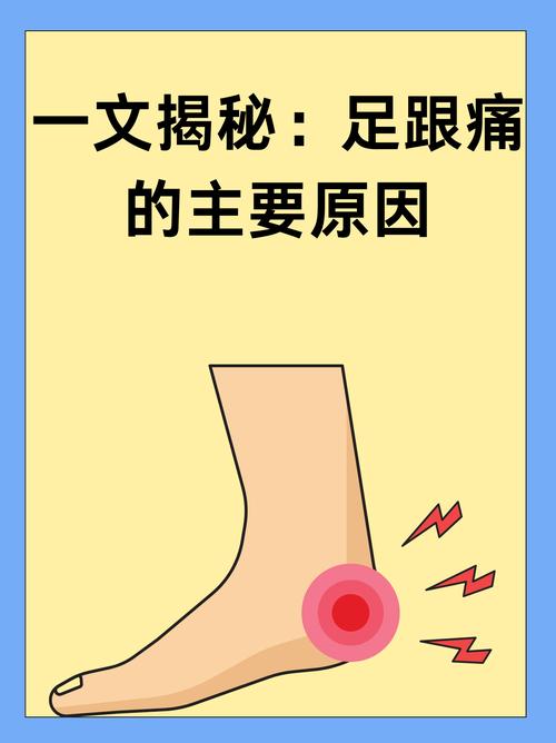 儿童脚后跟疼是什么原因有三-第1张图片-中州医学会