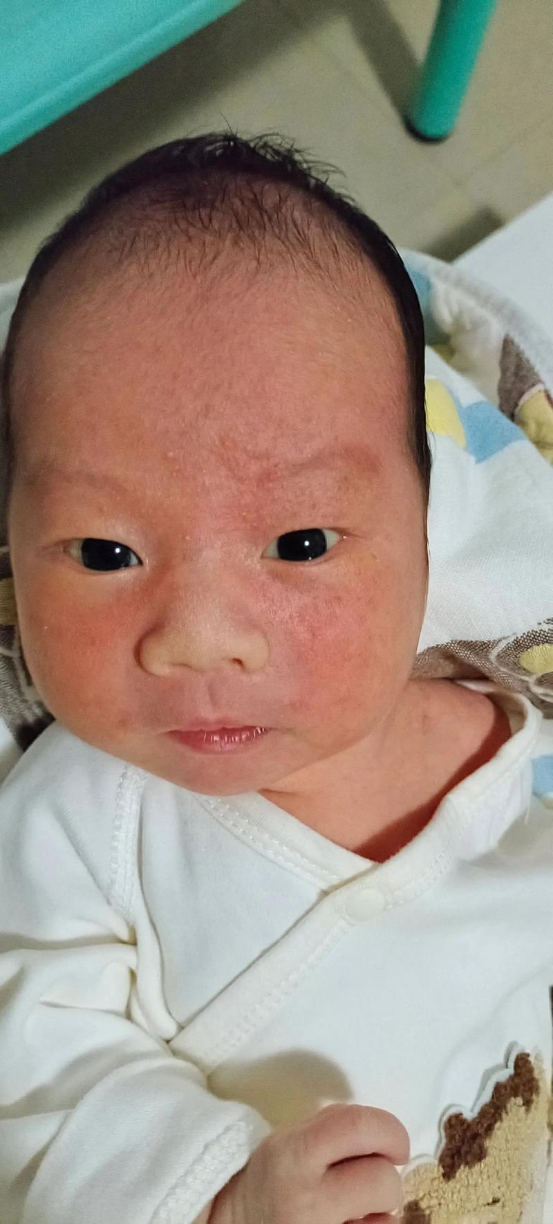 新生儿脸小红点带白头是啥？-第1张图片-中州医学会