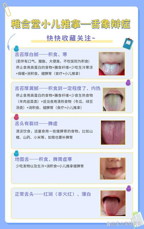 新生儿舌苔厚白是何原因？-第1张图片-中州医学会