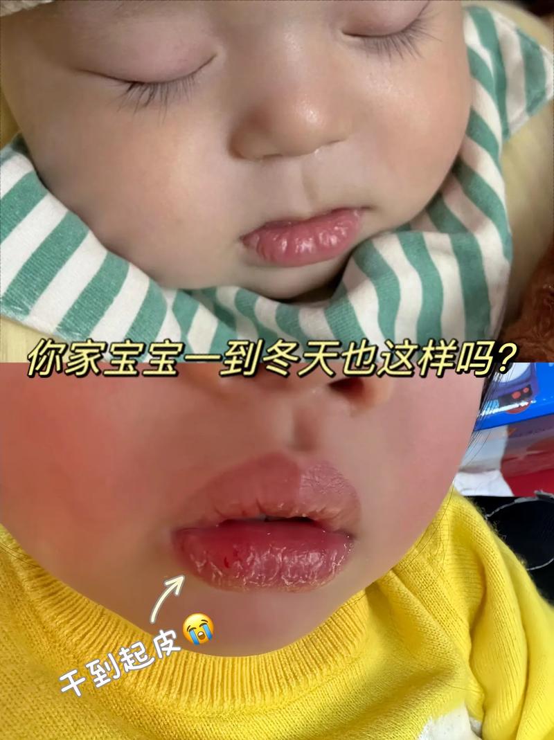 新生儿下嘴唇老颤抖是怎么回事-第1张图片-中州医学会