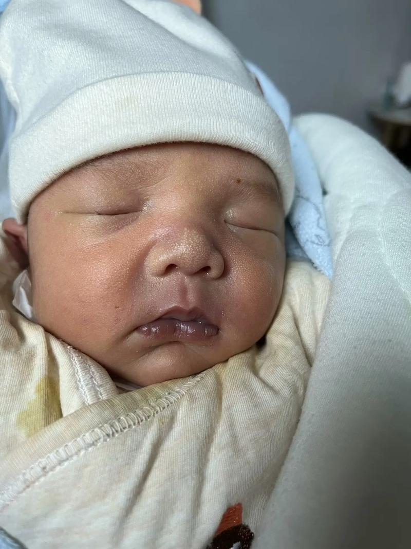 新生儿嘴发紫是缺氧吗？-第2张图片-中州医学会