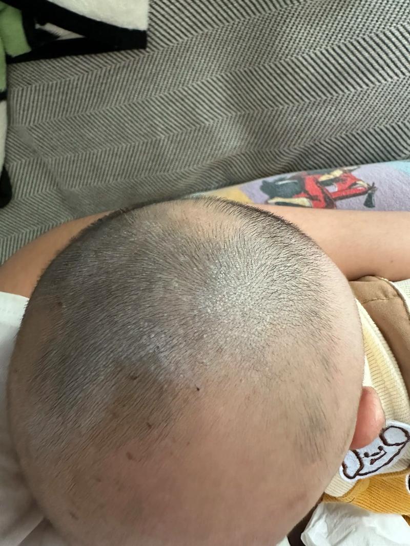 孕期吃什么真能让宝宝头发多又黑?-第1张图片-中州医学会 孕期吃什么真能让宝宝头发多又黑?-第1张图片-中州医学会