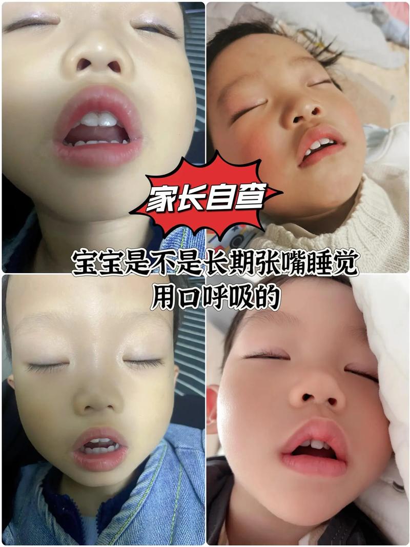 新生儿22天睡觉哼哼唧唧是正常现象吗?-第2张图片-中州医学会 新生儿22天睡觉哼哼唧唧是正常现象吗?-第2张图片-中州医学会