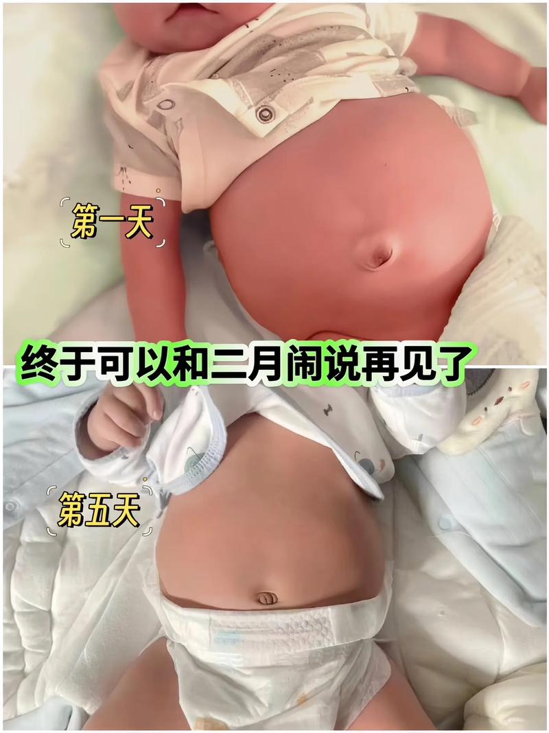 新生儿肚子鼓鼓是正常现象吗？-第1张图片-中州医学会