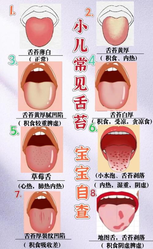 儿童地图舌是何原因引起？-第2张图片-中州医学会