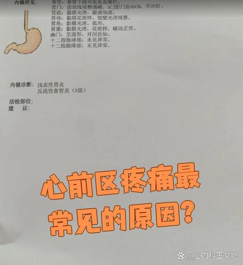 儿童心前区疼最常见原因是什么？-第2张图片-中州医学会