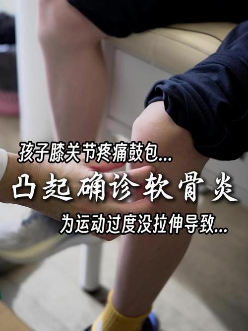 儿童运动后膝盖疼，是生长痛还是伤？-第2张图片-中州医学会