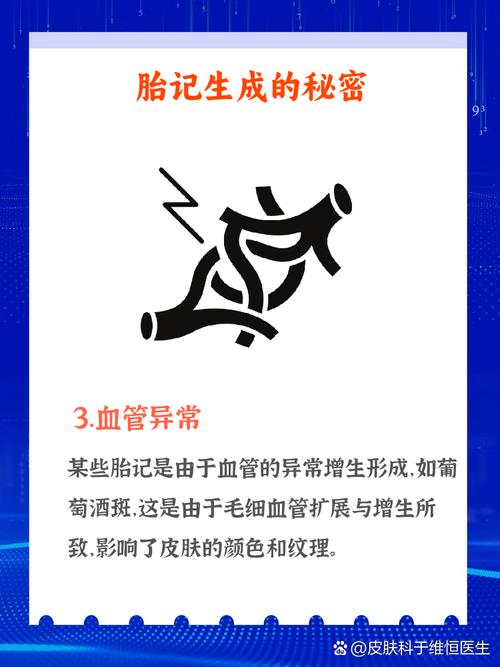 新生儿长胎记是何原因造成？-第3张图片-中州医学会