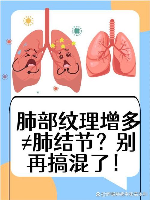 新生儿肺部纹理增多是什么意思-第2张图片-中州医学会