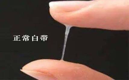 怀孕黑色分泌物正常吗？-第2张图片-中州医学会