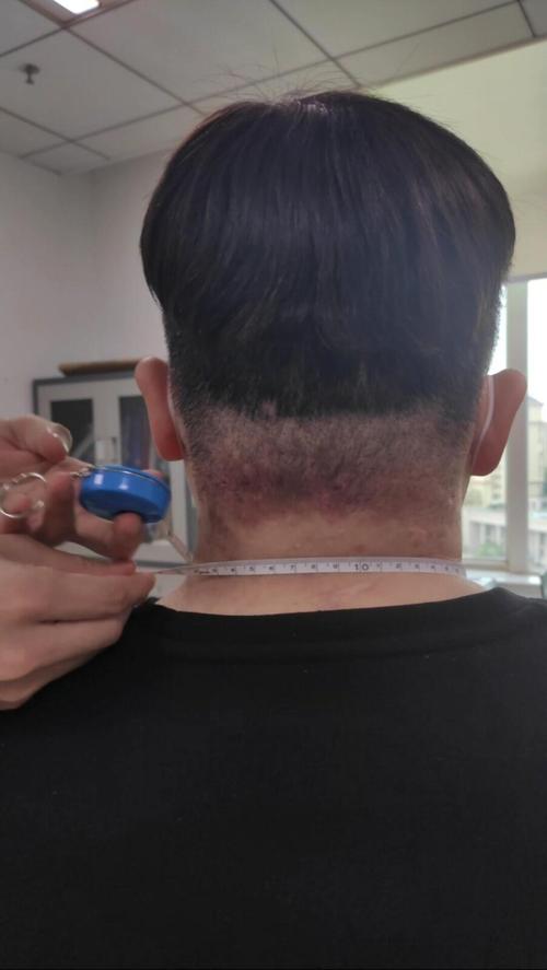 怀孕黑色分泌物正常吗？-第1张图片-中州医学会