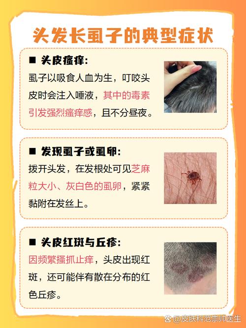 怀孕期间头上长虱子怎么办-第2张图片-中州医学会