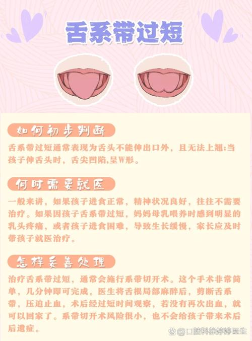 儿童舌系带短手术费用是多少？-第3张图片-中州医学会