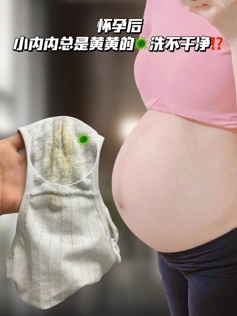 孕期私处异味咋办？-第3张图片-中州医学会