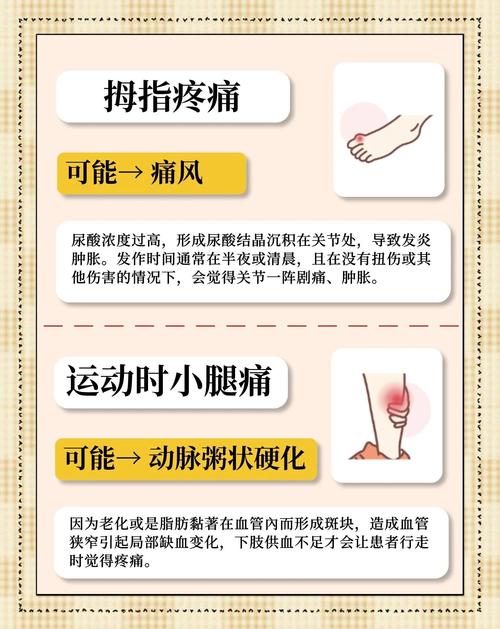 孕期脚酸痛，是缺钙还是其他原因？-第2张图片-中州医学会