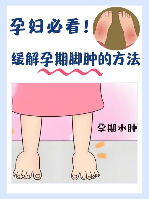 孕期脚酸痛，是缺钙还是其他原因？-第1张图片-中州医学会