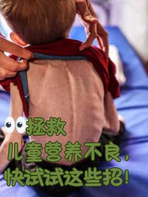 孩子矮小、发育慢?警惕生长激素缺乏!-第2张图片-中州医学会 孩子矮小、发育慢?警惕生长激素缺乏!-第2张图片-中州医学会