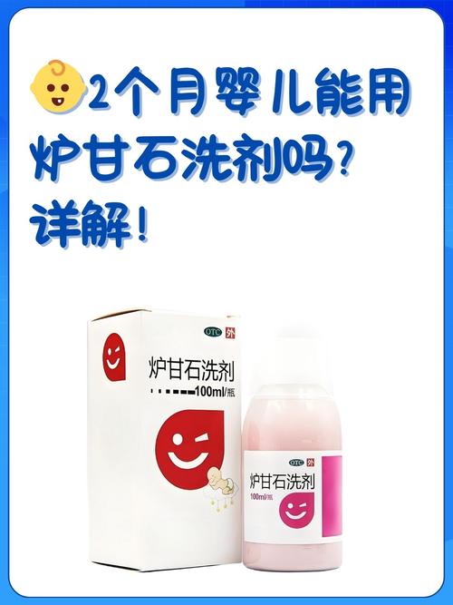 新生儿湿疹能用炉甘石吗？-第1张图片-中州医学会