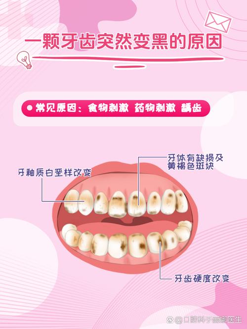孕期牙齿为何会变黑?-第1张图片-中州医学会 孕期牙齿为何会变黑?-第1张图片-中州医学会