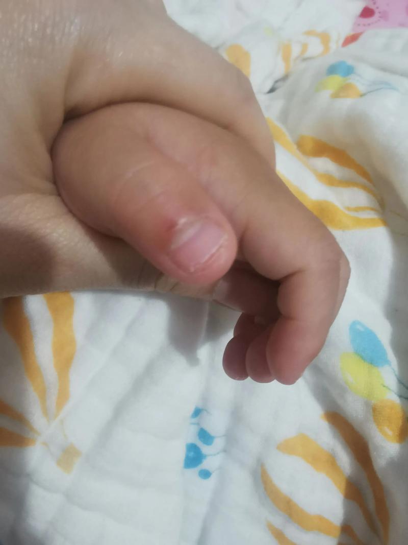 10岁孩子总咬指甲，是缺营养还是心理压力？-第2张图片-中州医学会