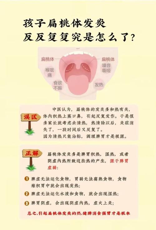 儿童扁桃体白色脓点怎么快速消除？-第3张图片-中州医学会