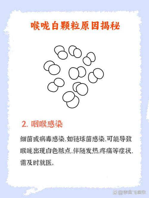 儿童扁桃体白色脓点怎么快速消除?-第1张图片-中州医学会 儿童扁桃体白色脓点怎么快速消除?-第1张图片-中州医学会