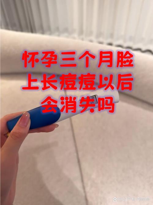 孕期为何脸上长粉刺?-第1张图片-中州医学会 孕期为何脸上长粉刺?-第1张图片-中州医学会