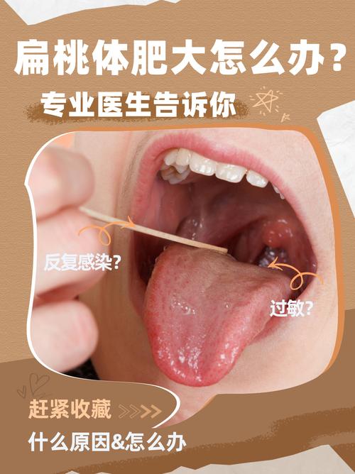 儿童扁桃体肥大，中医能治吗？-第2张图片-中州医学会