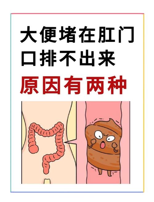 儿童大便硬堵肛门,如何快速解决?-第3张图片-中州医学会 儿童大便硬堵肛门,如何快速解决?-第3张图片-中州医学会