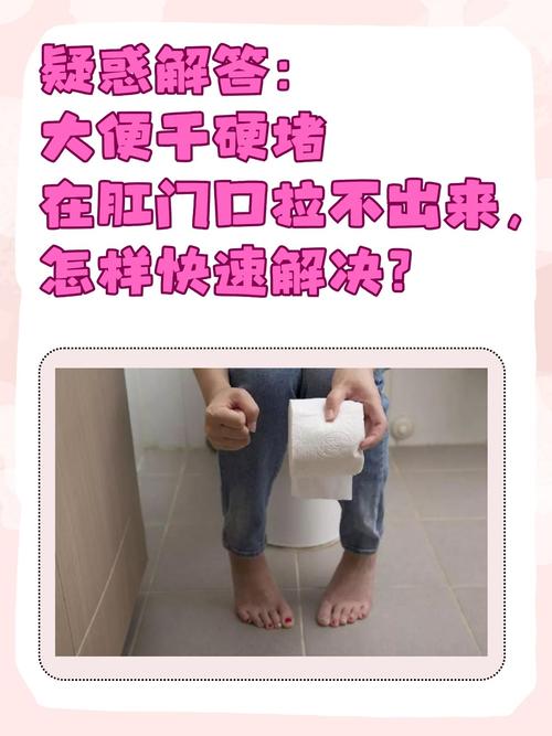 儿童大便硬堵肛门，如何快速解决？-第2张图片-中州医学会