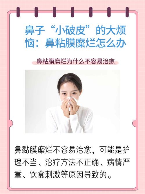 儿童鼻粘膜糜烂鼻出血怎么办？-第3张图片-中州医学会