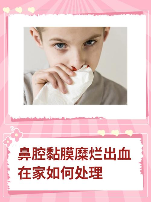 儿童鼻粘膜糜烂鼻出血怎么办？-第1张图片-中州医学会