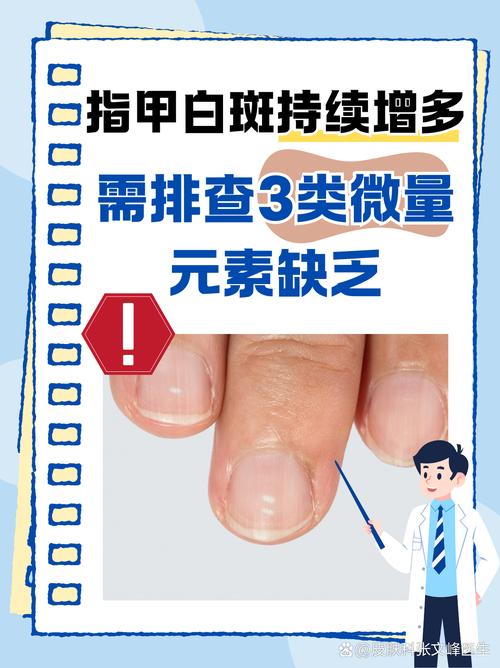 儿童指甲白斑是缺钙还是生病了？-第2张图片-中州医学会