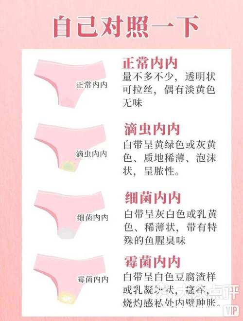 孕期白带发黄无异味无瘙痒要紧吗?-第3张图片-中州医学会 孕期白带发黄无异味无瘙痒要紧吗?-第3张图片-中州医学会