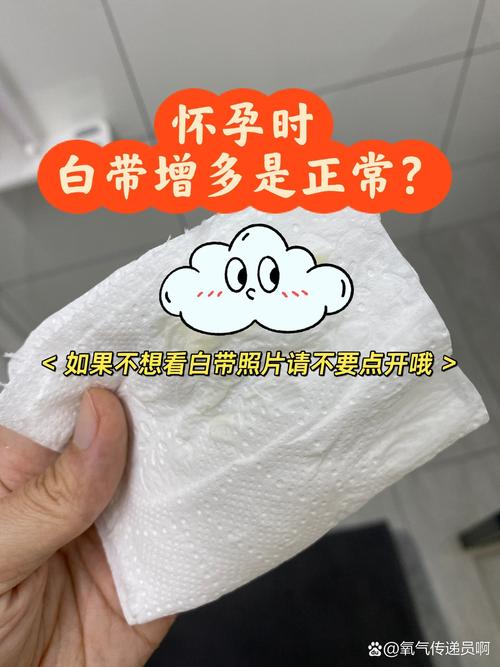 孕期白带发黄无异味无瘙痒要紧吗?-第1张图片-中州医学会 孕期白带发黄无异味无瘙痒要紧吗?-第1张图片-中州医学会