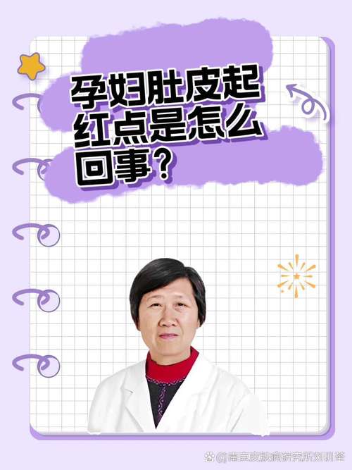 孕期肚皮红点是何原因?-第2张图片-中州医学会 孕期肚皮红点是何原因?-第2张图片-中州医学会