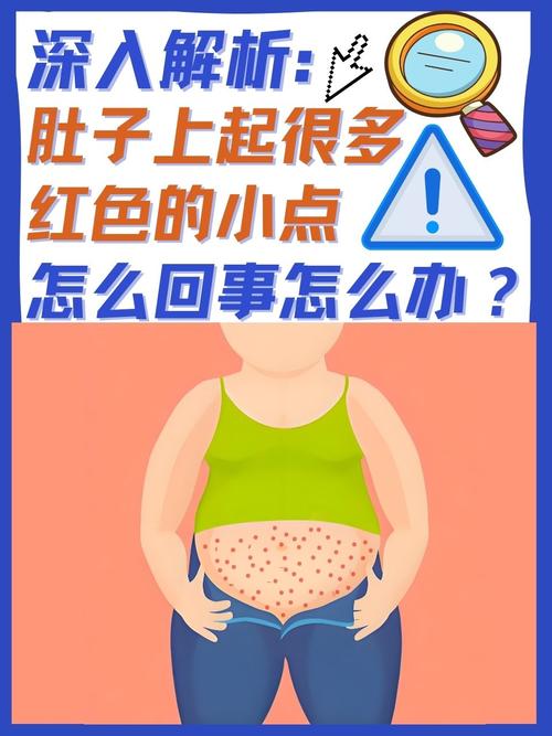 孕期肚皮红点是何原因?-第1张图片-中州医学会 孕期肚皮红点是何原因?-第1张图片-中州医学会