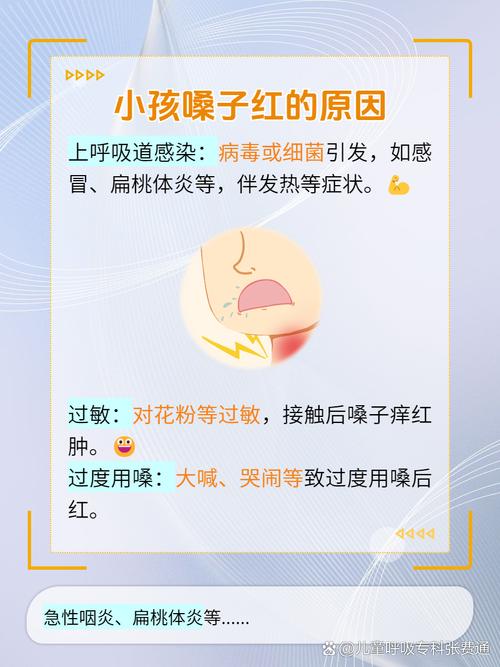 儿童急性咽喉炎症状有哪些？-第3张图片-中州医学会