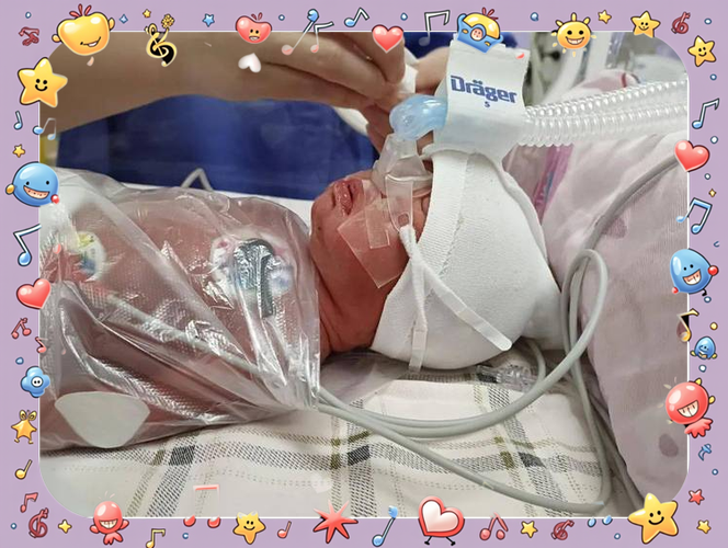 SLE50000新生儿呼吸机有何核心技术优势？-第1张图片-中州医学会