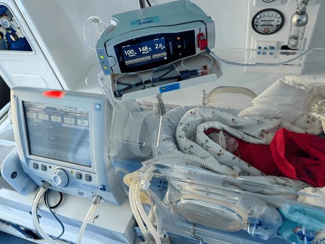 SLE50000新生儿呼吸机有何核心技术优势？-第3张图片-中州医学会